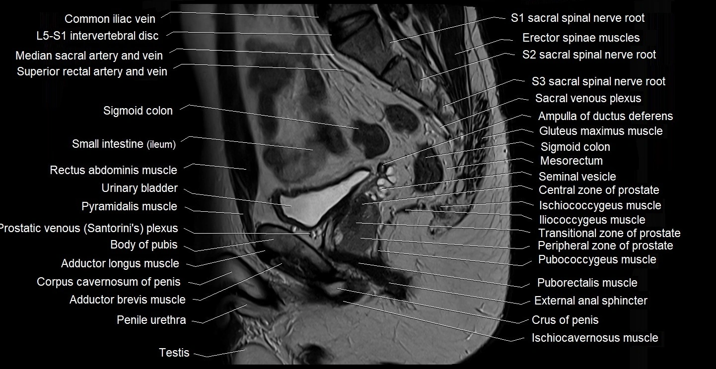 male pelvis sagittal cross sectional anatomy 3T mri image 20.webp